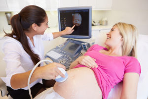 4D Ultrasound