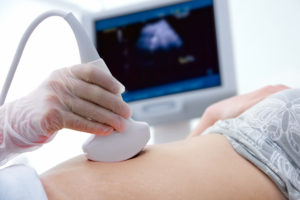 buy an ultrasound